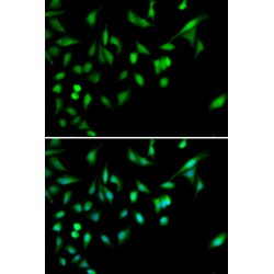 Mitogen-Activated Protein Kinase 14 (MAPK14) Antibody