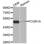 Western blot analysis of extracts of various cell lines, using FCGR1A antibody.