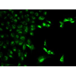High Affinity Immunoglobulin Gamma Fc Receptor I / CD64 (FCGR1A) Antibody
