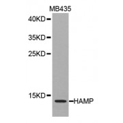 Western blot analysis of extracts of MB435 cell lines, using HAMP antibody.
