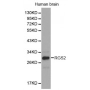 Western blot analysis of extracts of human brain cell lines, using RGS2 antibody.