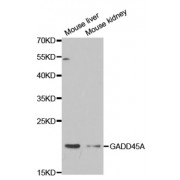 Western blot analysis of extracts of various cell lines, using GADD45A antibody.