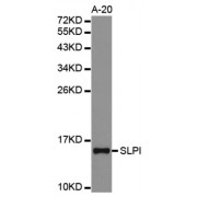 Western blot analysis of extracts of A-20 cell lines, using SLPI antibody.