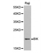 Western blot analysis of extracts of Raji cell line, using BIK antibody.