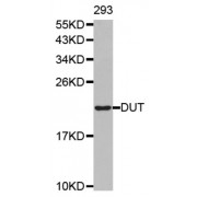 Western blot analysis of extracts of 293 cell line, using DUT antibody.