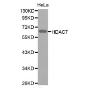 Western blot analysis of extracts of HeLa cell line, using HDAC7 antibody.