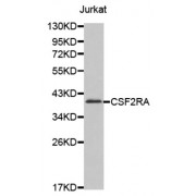 Western blot analysis of extracts of Jurkat cell line, using CSF2RA antibody.