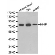 Western blot analysis of extracts of various cell lines, using HHIP antibody.