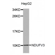Western blot analysis of extracts of HepG2 cell lines, using NDUFV3 antibody.