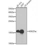 Western blot analysis of extracts of various cell lines, using Acetyl-Histone H3-K27 antibody (abx000001) at 1/1000 dilution.
