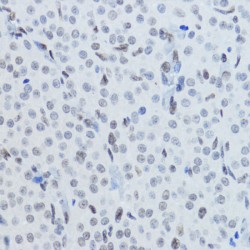 Histone H3K27AC Antibody