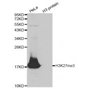 Western blot analysis of extracts of various cell lines, using Trimethyl-Histone H3-K27 antibody (abx000010) at 1/500 dilution.