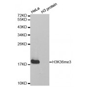 Western blot analysis of extracts of various cell lines, using Trimethyl-Histone H3-K36 antibody (abx000013).