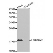 Western blot analysis of extracts of various cell lines, using Trimethyl-Histone H3-K79 antibody (abx000016).