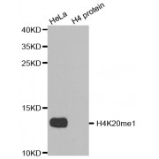 Western blot analysis of extracts of various cell lines, using Monomethyl-Histone H4-K20 antibody (abx000017).
