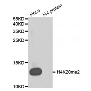 Western blot analysis of extracts of various cell lines, using Dimethyl-Histone H4-K20 antibody (abx000018).