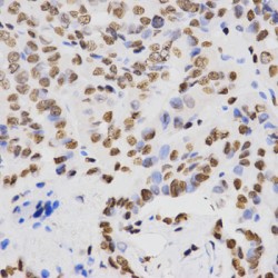 Histone H4K20me2 Antibody