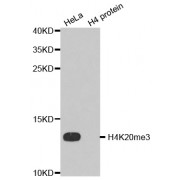 Western blot analysis of extracts of various cell lines, using Trimethyl-Histone H4-K20 antibody (abx000019).