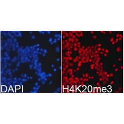Histone H4K20me3 Antibody