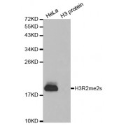 Western blot analysis of extracts of various cell lines, using Symmetric Dimethyl-Histone H3-R2 antibody (abx000020).