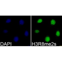 Histone H3R8me2s Antibody