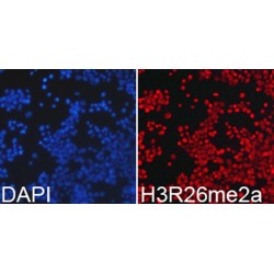 Histone H3R26me2a Antibody