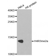 Western blot analysis of extracts of various cell lines, using Asymmetric Dimethyl-Histone H4-R3 antibody (abx000023).