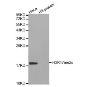 Western blot analysis of extracts of various cell lines, using Symmetric Dimethyl-Histone H3-R17 antibody (abx000026).