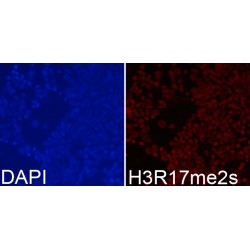 Histone H3R17me2s Antibody