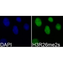 Histone H3R26me2s Antibody