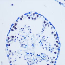 Histone H3R8me2a Antibody