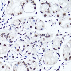 Histone H4R3me2s Antibody