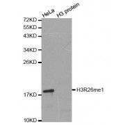 Western blot analysis of extracts of various cell lines, using Monomethyl-Histone H3-R26 antibody (abx000034).