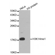 Western blot analysis of extracts of various cell lines, using Monomethyl-Histone H3-K14 antibody (abx000035).