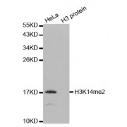 Western blot analysis of extracts of various cell lines, using Dimethyl-Histone H3-K14 antibody (abx000036).
