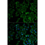 Immunofluorescence analysis of HeLa cells using TNFRSF1A antibody (abx000039). Blue: DAPI for nuclear staining.