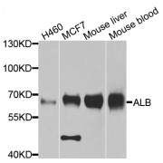 Western blot analysis of extracts of various cell lines, using ALB antibody (abx000044) at 1/1000 dilution.