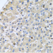 Immunohistochemistry of paraffin-embedded human liver using APOA5 antibody (abx000061) at dilution of 1/100 (40x lens).