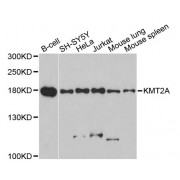 Western blot analysis of extracts of various cell lines, using KMT2A antibody (abx000063) at 1/1000 dilution.