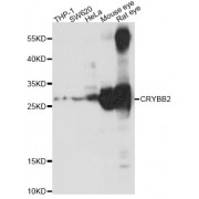 Western blot analysis of extracts of various cell lines,ing CRYBB2 antibody (abx000083) at 1/1000 dilution.