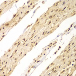 Caudal Type Homeobox 1 (CDX1) Antibody