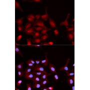 Immunofluorescence analysis of MCF-7 cells using Phospho-ABL1-Y245 antibody (abx000091). Blue: DAPI for nuclear staining.
