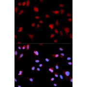 Immunofluorescence analysis of MCF-7 cells using Phospho-ABL1-Y204 antibody (abx000093). Blue: DAPI for nuclear staining.
