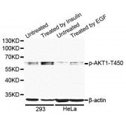 Western blot analysis of extracts of 293 and HeLa cells, using Phospho-AKT1-T450 antibody (abx000094) at 1/1000 dilution. 293 cells were treated by Insulin (100nM) for 10 minutes after serum-starvation overnight. HeLa cells were treated by EGF (100ng/ml) for 30 minutes after serum-starvation overnight.
