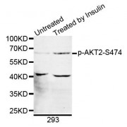 Western blot analysis of extracts of 293 cells, using Phospho-AKT2-S474 antibody (abx000095).