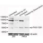 Western blot analysis of extracts of 293 and HeLa cells, using Phospho-FAS-Y291 antibody (abx000097) at 1/1000 dilution. 293 cells were treated by UV for 15-30 minutes. HeLa cells were treated by Doxorubicin (0.5uM) for 24 hours.