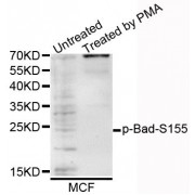 Western blot analysis of extracts of various cells, using Phospho-Bad-S155 antibody (abx000099).