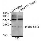 Western blot analysis of extracts of 293 cell line, using Phospho-Bad-S112 antibody (abx000100).