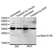 Western blot analysis of extracts of various cells, using Phospho-Bad-S136 antibody (abx000101).