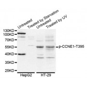 Western blot analysis of extracts of various cell lines, using Phospho-CCNE1-T395 antibody (abx000102).